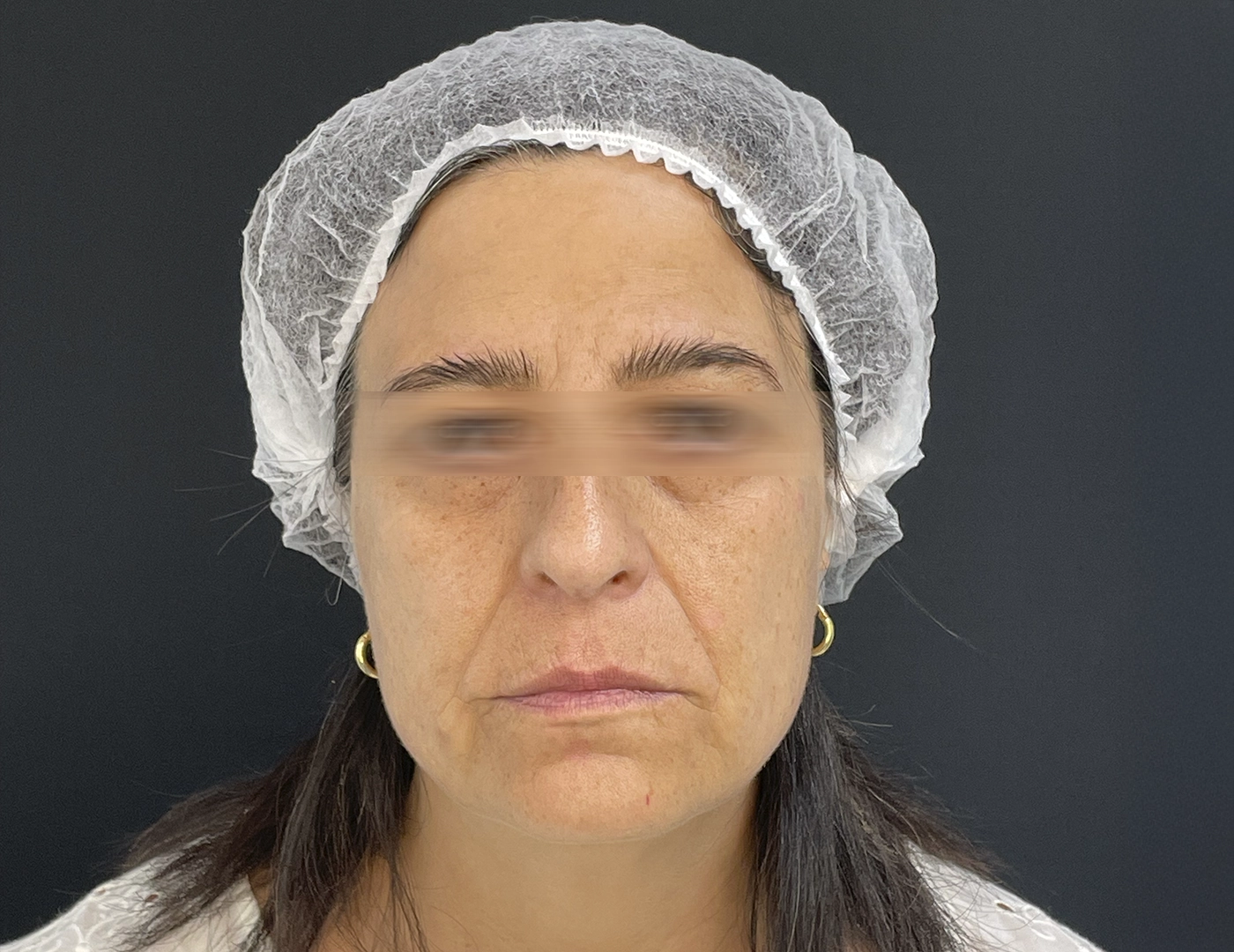 FULL_FACE_ANTES-2