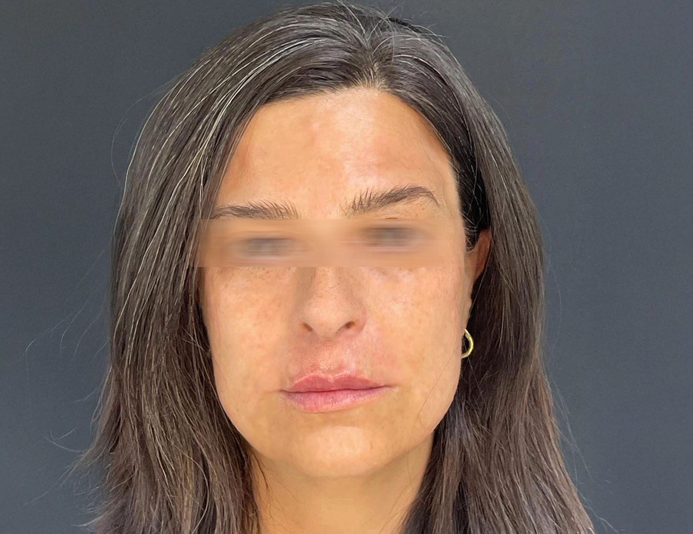 FULL_FACE_DSP-2